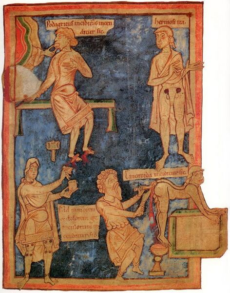 File:11th century English surgery.jpg