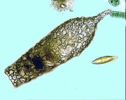 Difflugia acuminata.jpg