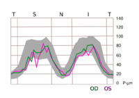 TSNIT graph