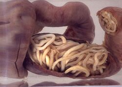 Piece of intestine, blocked by worms (16424898321).jpg