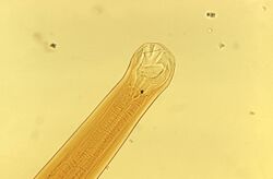 Ancylostoma braziliense mouth parts CDC PHIL ID1375.jpg