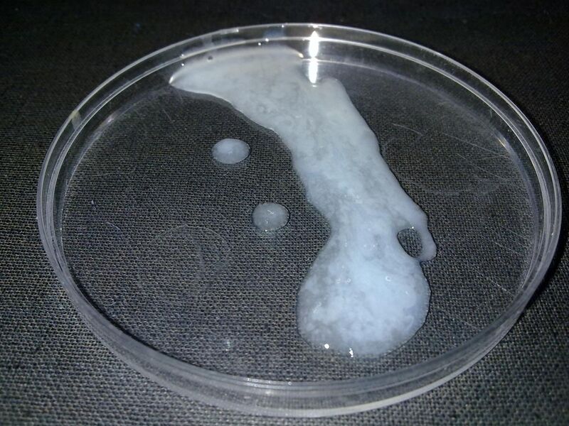 File:Human semen in a petri dish.jpg