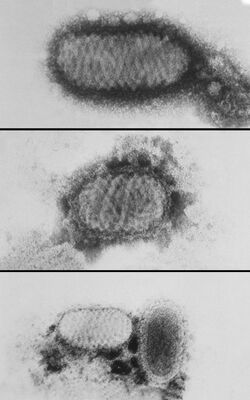 Parapox Orf virus - PHIL 5577 lores.jpg
