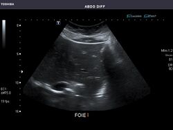 Abdominal Ultrasound Full Exam 03.jpg