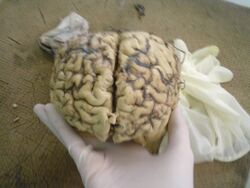 Brain dissection.jpg