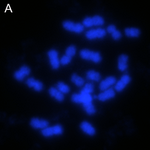 Karyotype of European beech (Fagus sylvatica).png