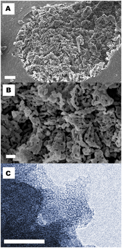 Electron microscopy images of Upsalite.png