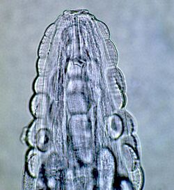 Gongylonema pulchrum nematode from man Figure 2b.jpg