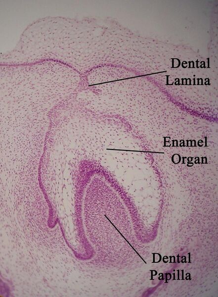 File:Toothhistology11-17-05.jpg