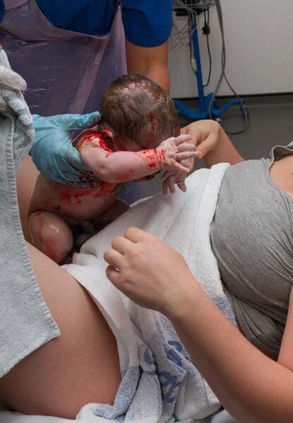 File:Infant at Childbirth.jpg
