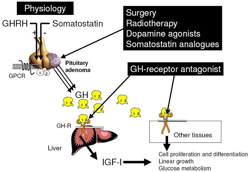File:Acromegaly treatment diagram.JPEG
