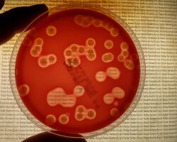 Beta hemolysis on blood agar.jpg