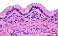 Histopathology of lining of a benign mucinous tumor of the ovary.jpg