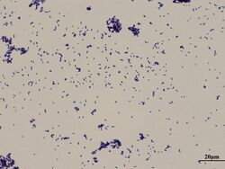 Corynebacterium xerosis Gram stain.jpg