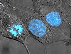 HeLa cells stained with Hoechst 33258.jpg