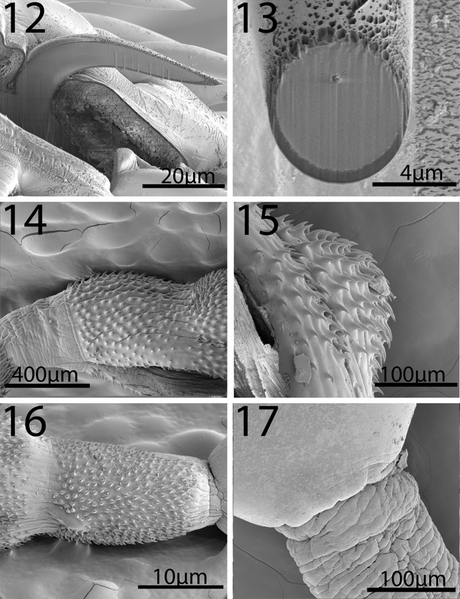 File:Parasite170077-fig 12-17 Neoandracantha peruensis (Acanthocephala)7.png