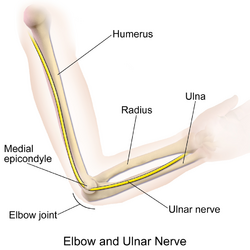 Cubital tunnel syndrom causes pain in ulnar nerve.