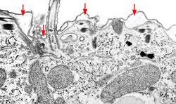 EM alveoli ciliate paramecium putrinum.jpg