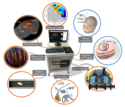 Main applications and features of functional ultrasound (fUS) imaging.svg