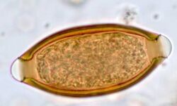 Parasite140080-fig3 Gastrointestinal parasites in seven primates of the Taï National Park - Helminths Figure 3i.jpg