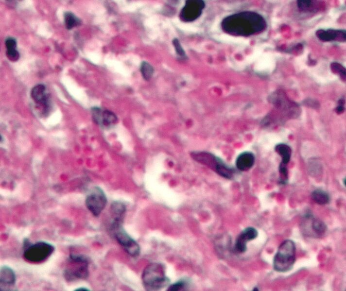 File:Histoplasma pas-d small.jpg