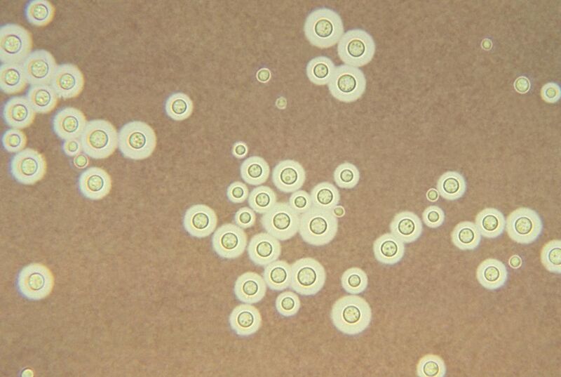 File:Cryptococcus neoformans using a light India ink staining preparation PHIL 3771 lores.jpg