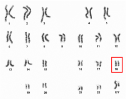 Human male karyotpe high resolution - Chromosome 18.png