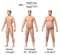 Obesity & BMI.png