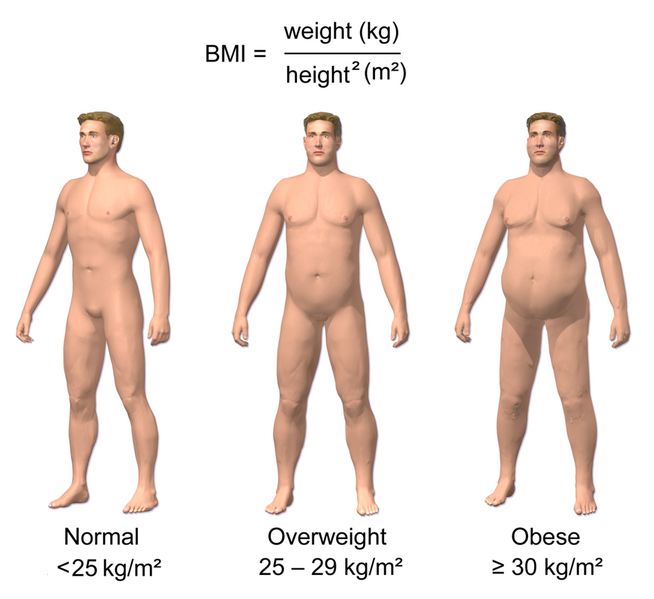 File:Obesity & BMI.png