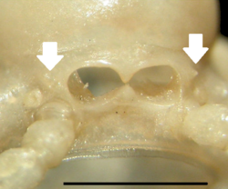 Chamberlinius gonopod aperture.png