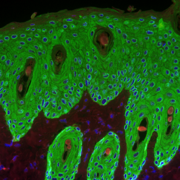 File:Proliferative response induced by a tumor promoter in the epidermis of a wild-type mouse - image.pbio.v11.i07.g001.png
