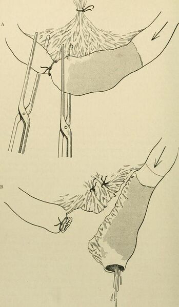 File:The principles and practice of surgery (1916) (14763802462).jpg