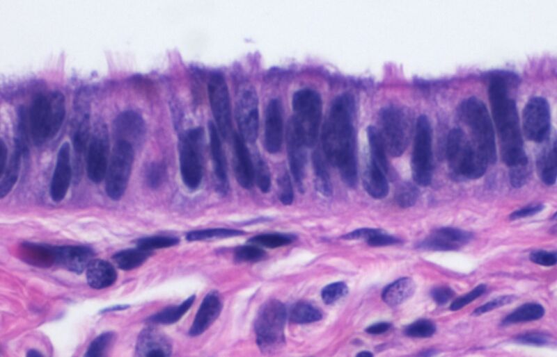 File:Histology of ciliated columnar epithelium of the fallopian tube.jpg