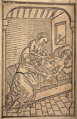 A baby being removed from its dying mother's womb via Caesar Wellcome V0014915.jpg