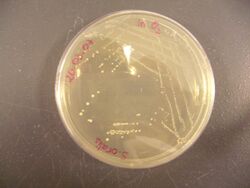 Streptococcus oralis on Wilkins-Chalgren Agar.JPG