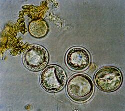 Entomophagamaimaiga azygospores.jpg