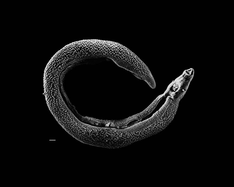 File:Schistosoma 20041-300.jpg