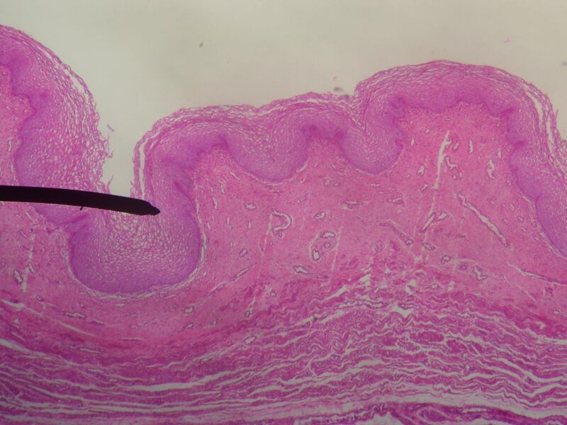 File:Vagina (mucosa).JPG