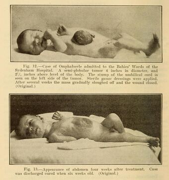 Diseases of infancy and childhood (1914) (14771602612).jpg