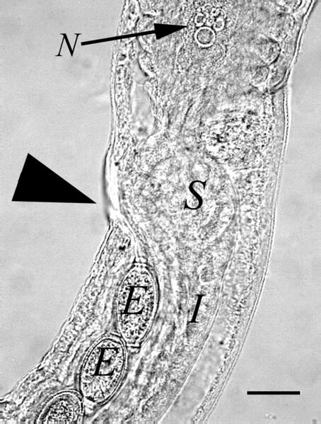 File:Eucoleus aerophilus female vulva.jpg