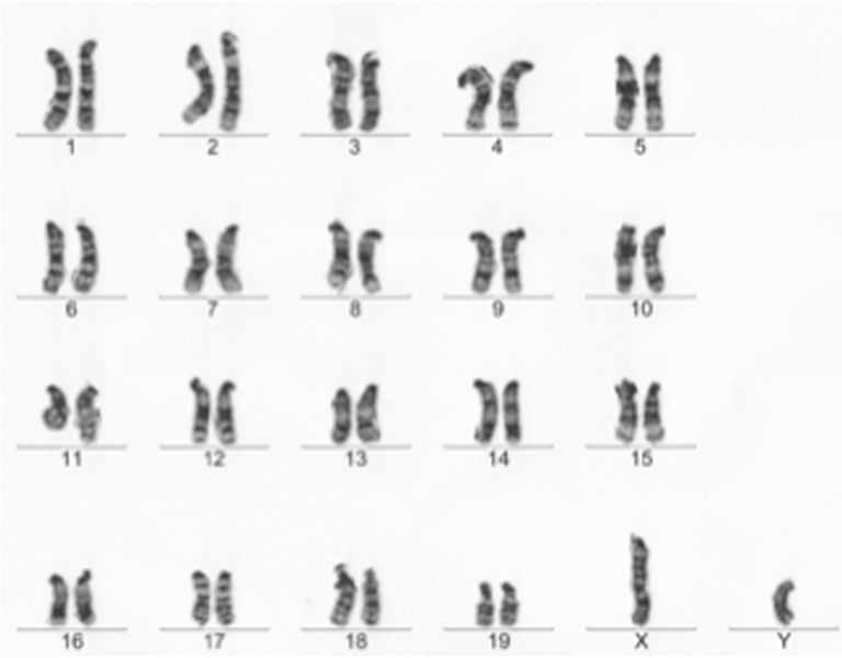 File:Karyotype of normal male mouse.png