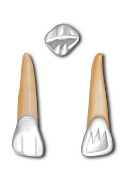 Maxillary lateral incisor.jpg