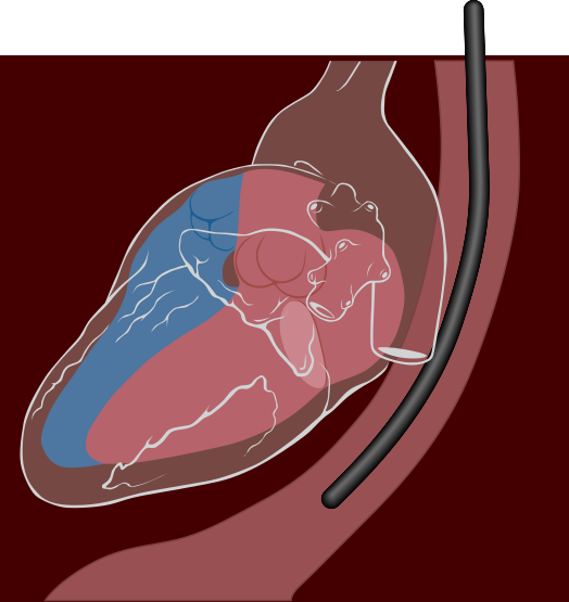 File:Transesophageal echocardiography diagram.svg