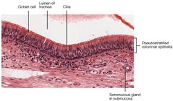 2304 Pseudostratified Epithelium.jpg