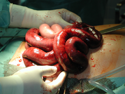 Ischemic small bowel during open abdominal surgery.