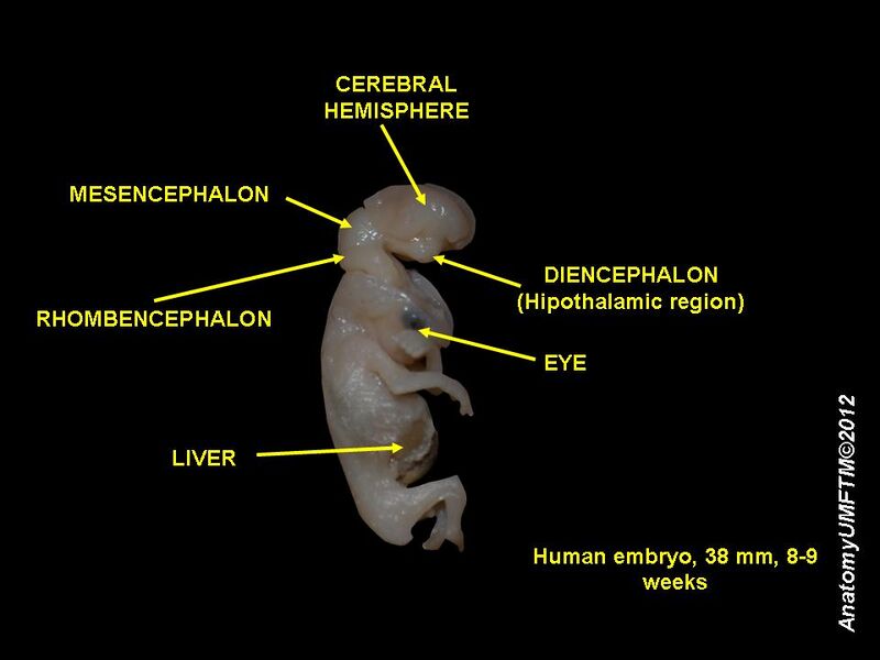 File:Human embryo 8 weeks 4.JPG
