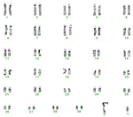 Karyotype of cattle.PNG