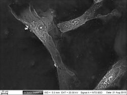 Limbal epithelium. Cells. SEM-BSE.jpg