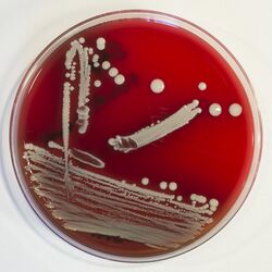 Staphylococcus condimenti Columbia-Blutagar 072.jpg