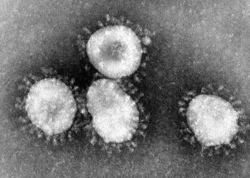 File:Coronaviruses 004 lores.jpg